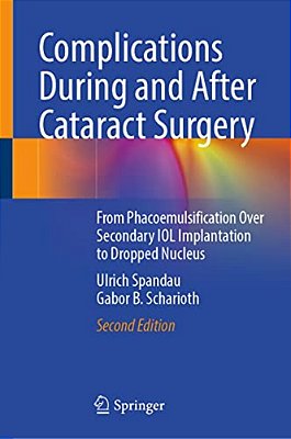 Complications During And After Cataract Surgery: From Phacoemulsification Over Secondary Iol Implantation To Dropped Nucleus-..