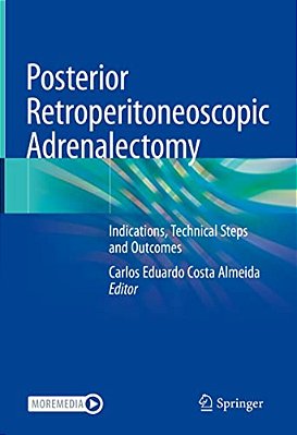 Posterior Retroperitoneoscopic Adrenalectomy: Indications, Technical Steps And Outcomes-..