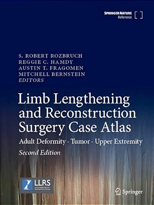 Limb Lengthening And Reconstruction Surgery Case Atlas: Adult Deformity - Tumor - Upper Extremity-..