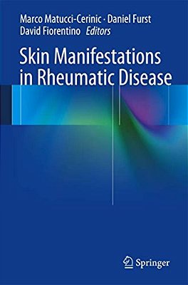 Skin Manifestations In Rheumatic Disease-..