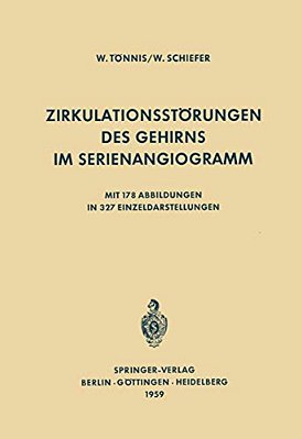 Zirkulationsstörungen Des Gehirns Im Serienangiogramm-..