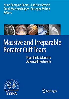 Massive And Irreparable Rotator Cuff Tears: From Basic Science To Advanced Treatments-..