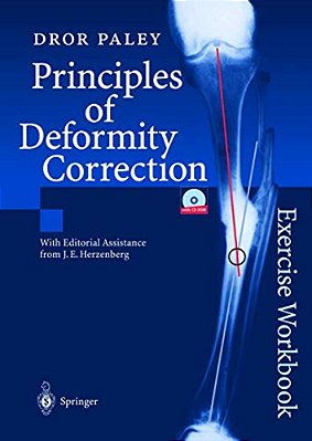 Principles Of Deformity Correction: Exercise Workbook-..