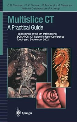 Multislice Ct: A Practical Guide-..