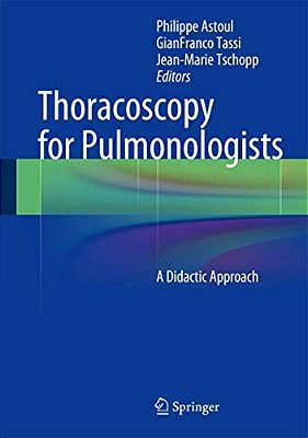 Thoracoscopy For Pulmonologists: A Didactic Approach-..