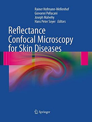 Reflectance Confocal Microscopy For Skin Diseases-..