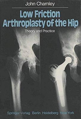 Low Friction Arthroplasty Of The Hip: Theory And Practice-..