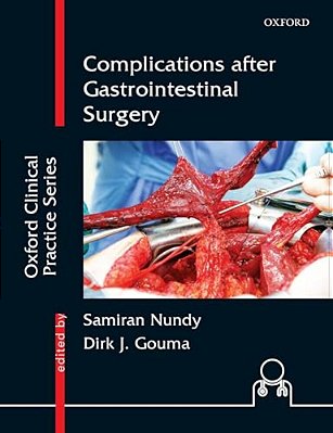 Complications After Gastrointestinal Surgery-..