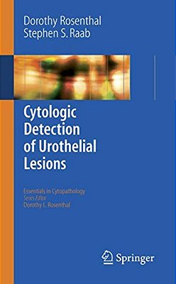 Cytologic Detection Of Urothelial Lesions-..