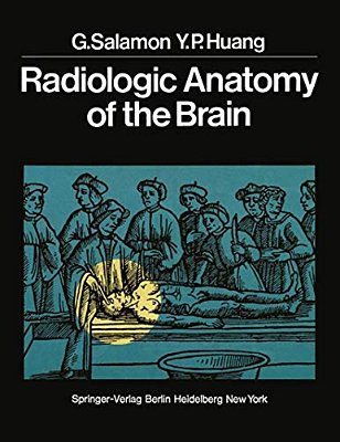 Radiologic Anatomy Of The Brain-..