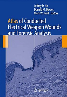 Atlas Of Conducted Electrical Weapon Wounds And Forensic Analysis-..