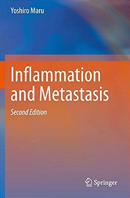Inflammation And Metastasis-..