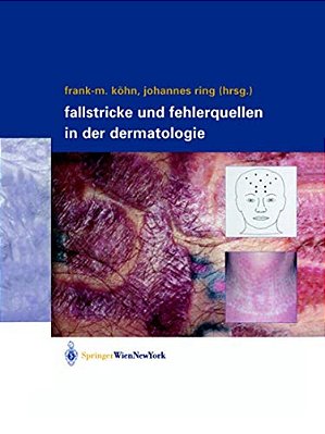 Fallstricke Und Fehlerquellen In Der Dermatologie-..