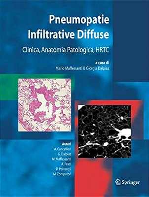 Pneumopatie Infiltrative Diffuse: Clinica, Anatomia Patologica, Hrtc-..