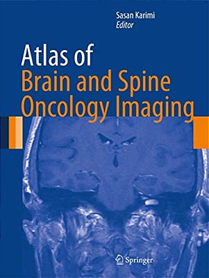 Atlas Of Brain And Spine Oncology Imaging-..