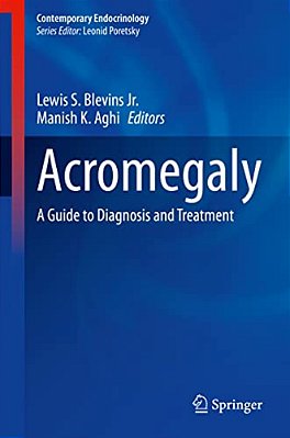 Acromegaly: A Guide To Diagnosis And Treatment-..