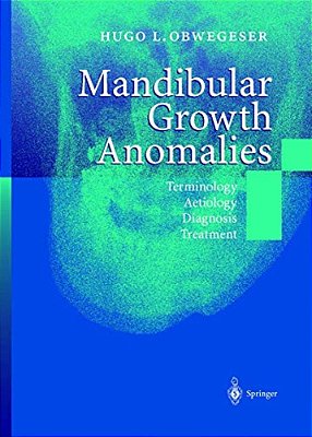 Mandibular Growth Anomalies: Terminology - Aetiology Diagnosis - Treatment-..