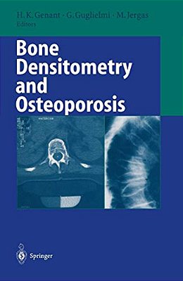 Bone Densitometry And Osteoporosis-..