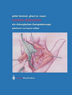 Morbus Dupuytren: Ein Chirurgisches Therapiekonzept-..