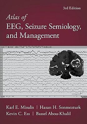 Atlas Of Eeg, Seizure Semiology, And Management-..