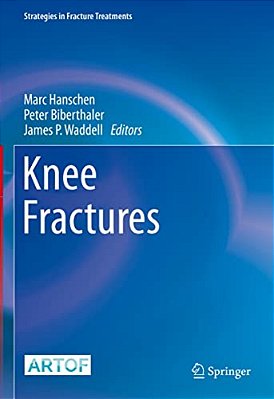 Knee Fractures-..
