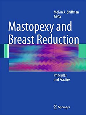 Mastopexy And Breast Reduction: Principles And Practice-..