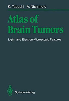 Atlas Of Brain Tumors: Light- And Electron-Microscopic Features-..