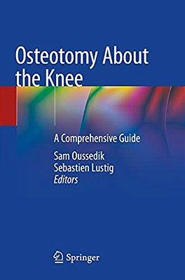 Osteotomy About The Knee: A Comprehensive Guide-..