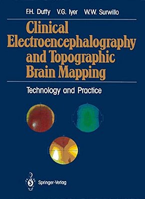 Clinical Electroencephalography And Topographic Brain Mapping: Technology And Practice-..