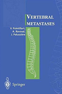Vertebral Metastases-..