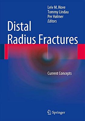 Distal Radius Fractures: Current Concepts-..