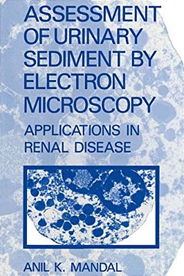 Assessment Of Urinary Sediment By Electron Microscopy: Applications In Renal Disease-..