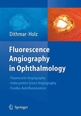 Fluorescence Angiography In Ophthalmology-..