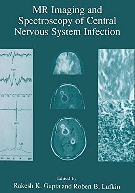 Mr Imaging And Spectroscopy Of Central Nervous System Infection-..