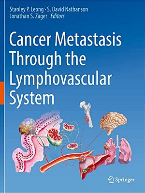 Cancer Metastasis Through The Lymphovascular System-..
