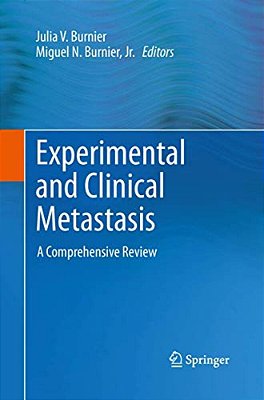 Experimental And Clinical Metastasis: A Comprehensive Review-..