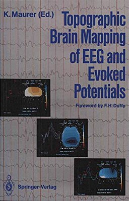 Topographic Brain Mapping Of Eeg And Evoked Potentials-..