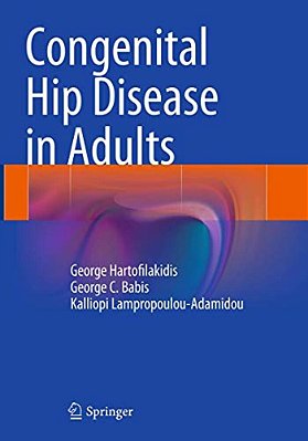 Congenital Hip Disease In Adults-..