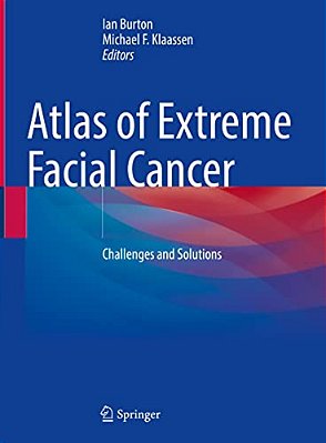 Atlas Of Extreme Facial Cancer: Challenges And Solutions-..