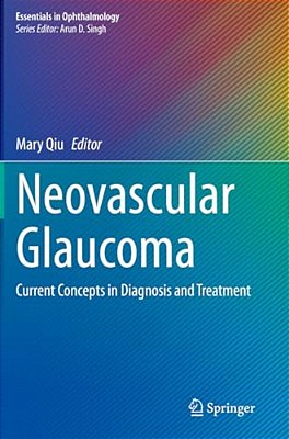 Neovascular Glaucoma: Current Concepts In Diagnosis And Treatment-..