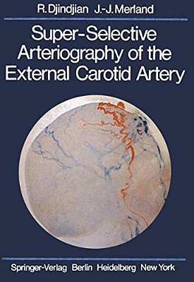 Super-Selective Arteriography Of The External Carotid Artery-..
