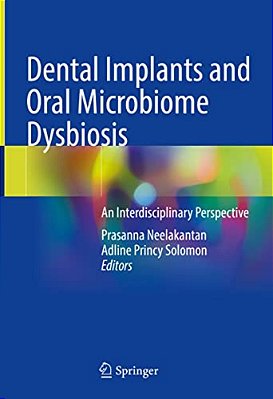 Dental Implants And Oral Microbiome Dysbiosis: An Interdisciplinary Perspective-..