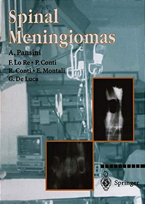Spinal Meningiomas-..