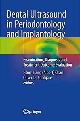 Dental Ultrasound In Periodontology And Implantology: Examination, Diagnosis And Treatment Outcome Evaluation-..