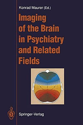 Imaging Of The Brain In Psychiatry And Related Fields-..