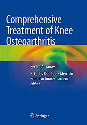 Comprehensive Treatment Of Knee Osteoarthritis: Recent Advances-..