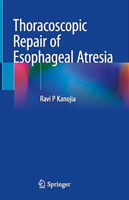Thoracoscopic Repair Of Esophageal Atresia-..
