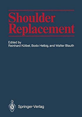 Shoulder Replacement-..