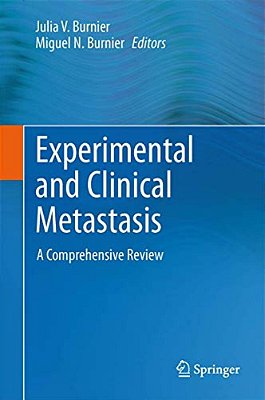 Experimental And Clinical Metastasis: A Comprehensive Review-..