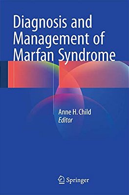 Diagnosis And Management Of Marfan Syndrome-..